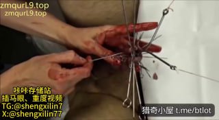 #超重口慎入_重度 长针 穿刺 鸡巴的封面